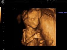 3D preivew - Gender scan